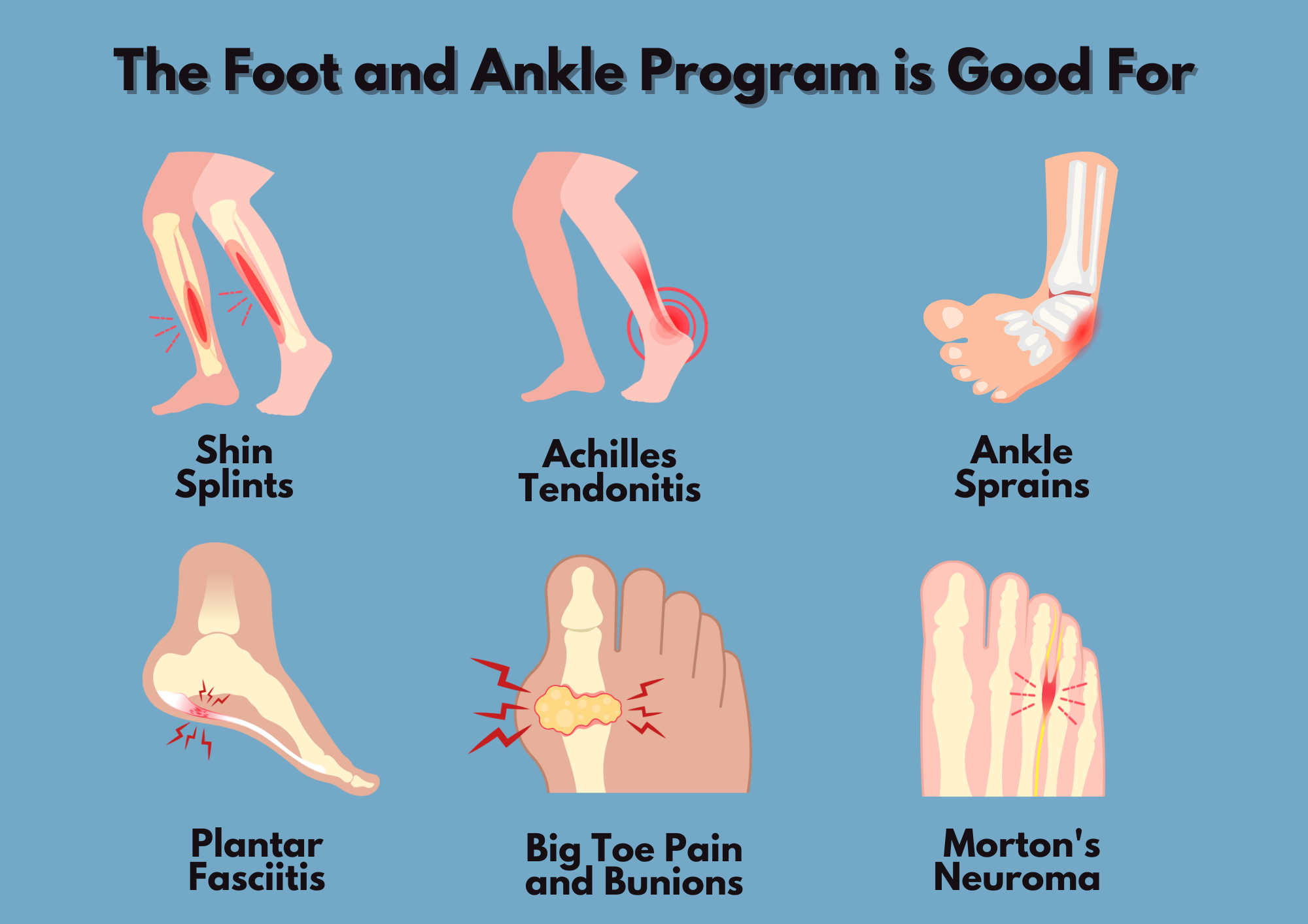 The Foot and Ankle Program is Good For The Foot and Ankle Program is Good For
